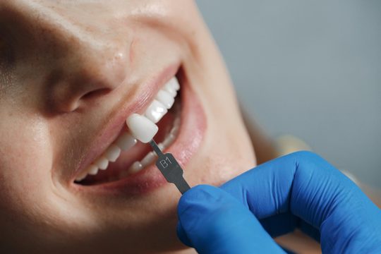 Dentist whiting teeth